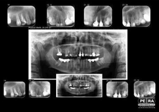 Radiografii OPG + I.O. digitale pe acelasi film de la Petra Laboratory - Centrul De Radiologie Digitala Stomatolog