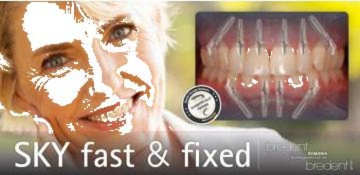 Implant dentar Bredent Fast and Fixed